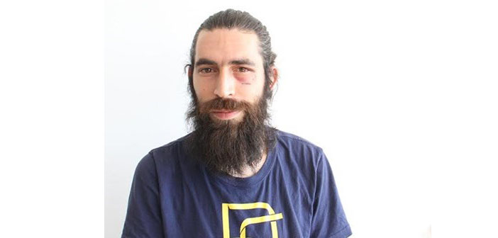 Bayrak tutmadı diye dövülen Çalışkan: Fransız değil, Yozgatlıyım