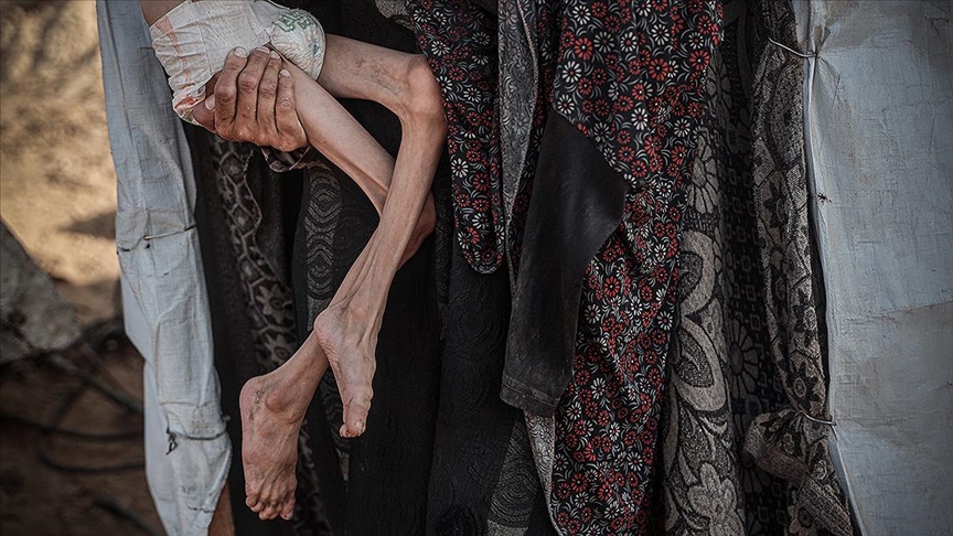 İsrail'in kıtlığı dayattığı Gazze'de 453 kişi açlıktan hayatını kaybetti