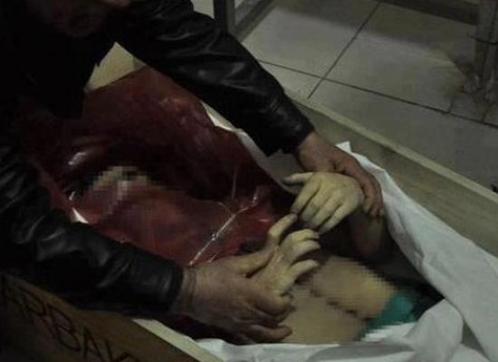 Otopsi raporuna göre Şahin Öner’in 4 kaburgası ezildi bomba iziyse yok